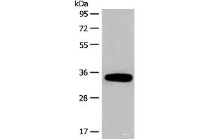 Western blot analysis of Human fetal liver tissue lysate using DHRS1 Polyclonal Antibody at dilution of 1:400 (DHRS1 Antikörper)