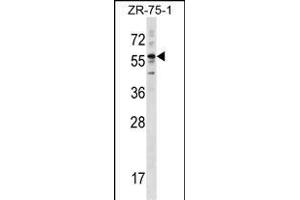 KRT3 Antibody (Center) (ABIN1538406 and ABIN2848455) western blot analysis in ZR-75-1 cell line lysates (35 μg/lane). (Keratin 3 Antikörper  (AA 414-441))