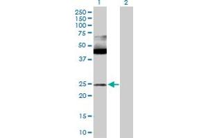 Western Blot analysis of MAX expression in transfected 293T cell line by MAX MaxPab polyclonal antibody. (MAX Antikörper  (AA 1-151))