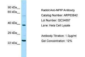 Western Blotting (WB) image for anti-Nuclear Pore Complex Interacting Protein Family, Member A1 (NPIPA1) (Middle Region) antibody (ABIN2789641) (NPIPA1 Antikörper  (Middle Region))