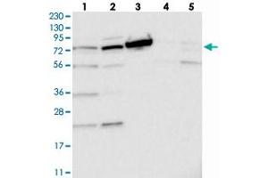 Western blot analysis of Lane 1: RT-4, Lane 2: U-251 MG, Lane 3: Human Plasma, Lane 4: Liver, Lane 5: Tonsil with TOP1MT polyclonal antibody . (TOP1MT Antikörper)