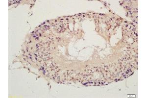 Formalin-fixed and paraffin embedded rat testis labeled with Rabbit Anti-SPDYA Polyclonal Antibody, Unconjugated (ABIN872729) at 1:200 followed by conjugation to the secondary antibody and DAB staining (SPDYA Antikörper  (AA 98-180))