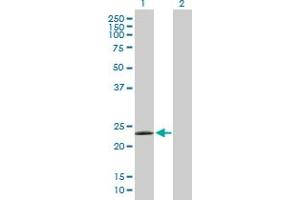 Western Blot analysis of LYG2 expression in transfected 293T cell line by LYG2 MaxPab polyclonal antibody. (LYG2 Antikörper  (AA 1-212))