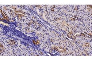 Immunohistochemistry (IHC) image for anti-Insulin-Like Growth Factor 1 (IGF1) (AA 49-118) antibody (ABIN7442501)