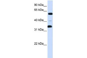 WB Suggested Anti-ZKSCAN1 Antibody Titration:  0. (ZKSCAN1 Antikörper  (Middle Region))