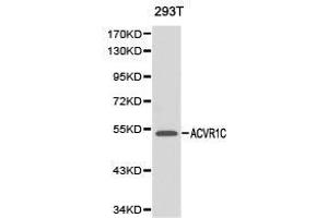 Western Blotting (WB) image for anti-Activin Receptor Type 1C (ACVR1C) antibody (ABIN1870797) (ACVR1C/ALK7 Antikörper)