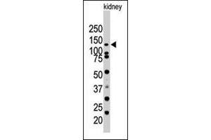 Western blot analysis of SENP7 polyclonal antibody  in mouse kidney tissue lysate (35 ug/lane).