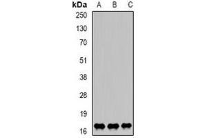 Western blot analysis of LITAF expression in K562 (A), Hela (B), HepG2 (C) whole cell lysates. (LITAF Antikörper)