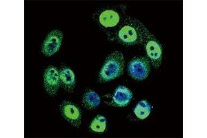 Confocal immunofluorescent analysis of phospho-SMAD4 antibody with HeLa cells followed by Alexa Fluor 488-conjugated goat anti-rabbit lgG (green). (SMAD4 Antikörper  (pThr277))
