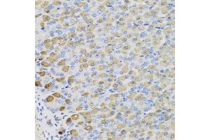 Immunohistochemistry of paraffin-embedded mouse stomach using LDHB antibody at dilution of 1:100 (x40 lens). (LDHB Antikörper)