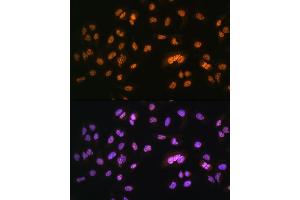 Immunofluorescence analysis of U2OS cells using NR2F2 Rabbit pAb (ABIN6133831, ABIN6144820, ABIN6144821 and ABIN6214430) at dilution of 1:100. (NR2F2 Antikörper  (AA 1-100))