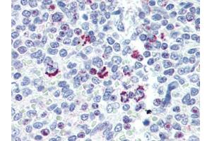 Human Spleen (formalin-fixed, paraffin-embedded) stained with LIN28Bfollowed by biotinylated goat anti-rabbit IgG secondary antibody, alkaline phosphatase-streptavidin and chromogen. (LIN28B Antikörper  (N-Term))