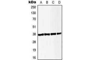 Western blot analysis of LAT (pY191) expression in HeLa PMA-treated (A), Jurkat CD3-treated (B), Raw264. (LAT Antikörper  (C-Term, pTyr191))