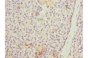 Immunohistochemistry of paraffin-embedded human pancreatic tissue using ABIN7175794 at dilution of 1:100 (WDR74 Antikörper  (AA 111-366))
