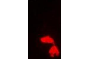 Immunofluorescent analysis of PA28 gamma staining in Hela cells. (PSME3 Antikörper)