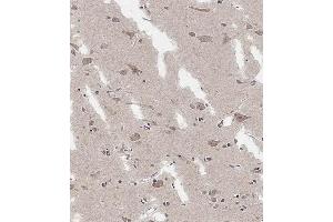 Immunohistochemistry (Paraffin-embedded Sections) (IHC (p)) image for anti-ADAM Metallopeptidase with thrombospondin Type 1 Motif, 17 (ADAMTS17) (AA 508-540) antibody (ABIN6243834)