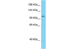 Host: Rabbit Target Name: Erc2 Sample Type: Mouse Liver lysates Antibody Dilution: 1. (ERC2 Antikörper  (C-Term))