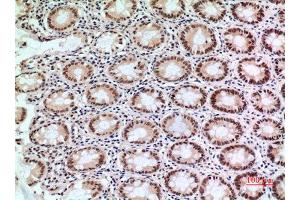 Immunohistochemistry (IHC) image for anti-Endothelial PAS Domain Protein 1 (EPAS1) (Ser343) antibody (ABIN3187839)