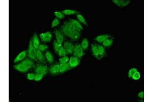 Immunofluorescent analysis of HepG2 cells using ABIN7173369 at dilution of 1:100 and Alexa Fluor 488-congugated AffiniPure Goat Anti-Rabbit IgG(H+L) (Slc25a1 Antikörper  (AA 144-182))