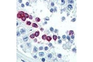 IHC analysis of FFPE human testis tissue stained with Cyclin D1 antibody