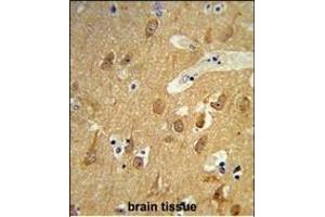 Formalin-fixed and raffin-embedded human brain tissue reacted with TSN12 Antibody (C-term), which was peroxidase-conjugated to the secondary antibody, followed by DAB staining. (TSPAN12 Antikörper  (C-Term))