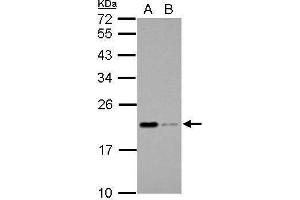 WB Image Sample (30 ug of whole cell lysate) A: THP-1 B: HL-60 12% SDS PAGE antibody diluted at 1:1000