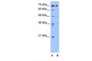 Image no. 1 for anti-Chromosome 9 Open Reading Frame 96 (C9orf96) (AA 581-630) antibody (ABIN321564)