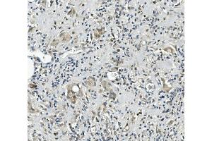 IHC analysis of Calretinin/CALB2 using anti-Calretinin/CALB2 antibody (ABIN7602106).