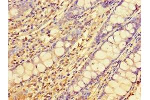 Immunohistochemistry of paraffin-embedded human colon tissue using ABIN7151556 at dilution of 1:100 (ELOVL1 Antikörper  (AA 82-175))