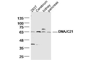 Lane 1: HT29 Cell lysates; Lane 2: mouse Cerebrum Cell lysates; Lane 3: Mouse kidney lysates; Lane 4: Mouse pancreas lysates; probed with DNAJC21 Polyclonal Antibody, unconjugated (bs-14387R) at 1:300 overnight at 4°C followed by a conjugated secondary antibody for 60 minutes at 37°C. (DNAJC21 Antikörper  (AA 11-120))