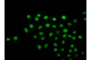 Immunofluorescence staining of Hela cells with ncrHU at 1:1, counter-stained with DAPI. (Histone H2B Antikörper)