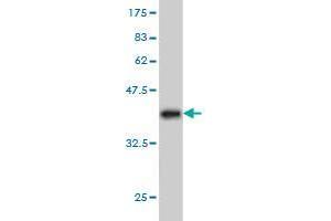 Western Blot detection against Immunogen (36. (PPP1R9A Antikörper  (AA 1090-1188))