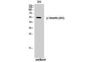 Western Blotting (WB) image for anti-Vimentin (VIM) (pSer83) antibody (ABIN3182647) (Vimentin Antikörper  (pSer83))