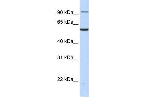 WB Suggested Anti-TNPO2 Antibody Titration: 0. (TNPO2 Antikörper  (N-Term))