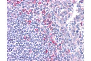 DLL1 antibody was used for immunohistochemistry at a concentration of 4-8 ug/ml. (DLL1 Antikörper)