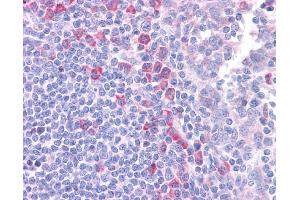 DLL1 antibody was used for immunohistochemistry at a concentration of 4-8 ug/ml. (DLL1 Antikörper)
