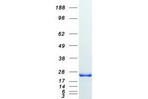 Western Blotting (WB) image for GTPase Kras (KRAS) (Transcript Variant B) protein (Myc-DYKDDDDK Tag) (ABIN2724421)