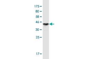 Western Blot detection against Immunogen (36. (VPS33B Antikörper  (AA 1-100))