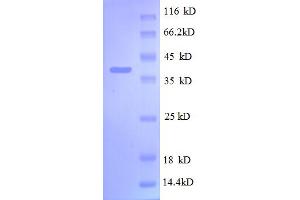 SDS-PAGE (SDS) image for Ribosomal Protein S13 (RPS13) (AA 2-118) protein (GST tag) (ABIN5712606) (RPS13 Protein (AA 2-118) (GST tag))
