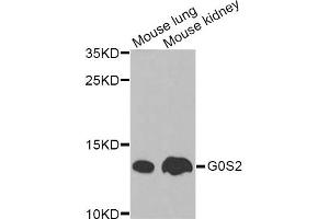 Western blot analysis of extracts of various cell lines, using G0S2 Antibody.
