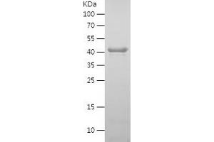 Western Blotting (WB) image for Sirtuin 2 (SIRT2) (AA 2-389) protein (His tag) (ABIN7282943) (SIRT2 Protein (AA 2-389) (His tag))