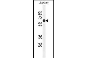 Western blot analysis in Jurkat cell line lysates (35ug/lane). (CCDC8 Antikörper  (C-Term))