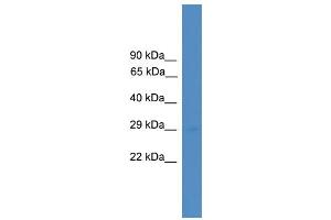 WB Suggested Anti-UBTD1 Antibody Titration: 0. (UBTD1 Antikörper  (Middle Region))