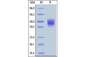 SDS-PAGE (SDS) image for SLAM Family Member 7 (SLAMF7) (AA 23-226) protein (His tag) (ABIN6388282)