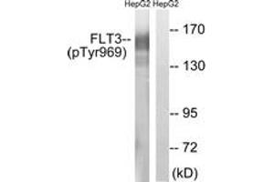 Western blot analysis of extracts from HepG2 cells treated with Na3VO4 0. (FLT3 Antikörper  (pTyr969))