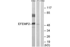 Western Blotting (WB) image for anti-Fibulin 4 (FBLN4) (Internal Region) antibody (ABIN1851282) (FBLN4 Antikörper  (Internal Region))