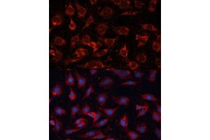 Immunofluorescence analysis of C6 cells using PDH Polyclonal Antibody (ABIN6132882, ABIN6145379, ABIN6145381 and ABIN6225274) at dilution of 1:100 (40x lens).