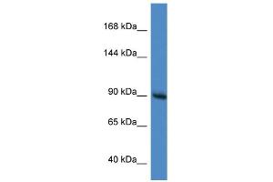 WB Suggested Anti-Rasa1 Antibody   Titration: 1. (RASA1 Antikörper  (C-Term))