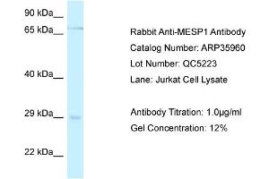 WB Suggested Anti-MESP1 Antibody   Titration: 1. (MESP1 Antikörper  (C-Term))