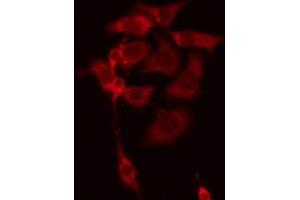 ABIN6278591 staining Hela by IF/ICC. (C18orf8 Antikörper  (C-Term))